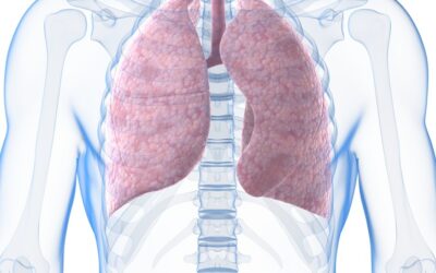 Células madre mesenquimales del cordón umbilical para la hipertensión arterial pulmonar grave