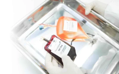 Seguridad de la infusión de células de sangre del cordón umbilical de hermanos en niños con parálisis cerebral