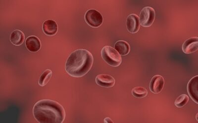 Estudio prospectivo de la utilidad del trasplante de sangre de cordón para el tratamiento de anemia aplásica