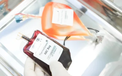 Trasplante de sangre del cordón umbilical en niños con anemia de Diamond-Blackfan