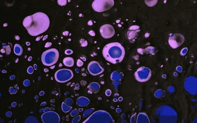 Tratamiento con sangre del cordón umbilical para niños con parálisis cerebral: metaanálisis de datos de participantes individuales