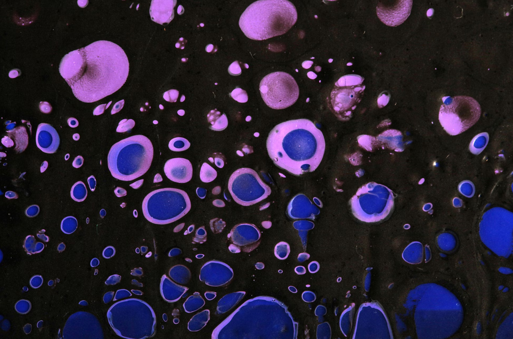 Terapia con células de cordón umbilical indica mejoras en niños con parálisis cerebral