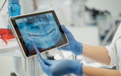 Células del cordón como tratamiento para la osteoartritis de la mandíbula