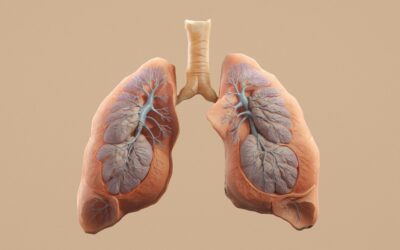 Células de cordón umbilical para la displasia broncopulmonar en prematuros: estudio de seguimiento